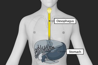 Diagram of the upper part of the body with the oesophagus highlighted in yellow and shown as a tube that runs from the mouth to the stomach.
